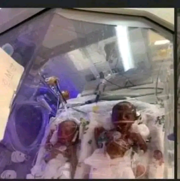 UNIZIK LECTURER GIVES BIRTH TO SEVEN BABIES