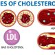How to Lower Cholesterol Naturally Without Medication
