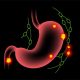 Top Nigerian Supplements for Ulcer Management