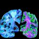 Early Signs of Alzheimer’s Disease in Seniors