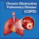 Breathing Exercises for People with COPD: Techniques That Can Help You Breathe Easier