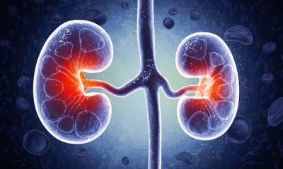 Best Diet for People with Chronic Kidney Disease
