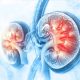 Foods to Avoid If You Have Kidney Problems