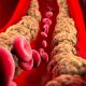 Natural Remedies to Manage High Cholesterol