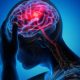 Natural Treatments for Migraines and Headaches