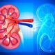 Natural Ways to Prevent Kidney Stones