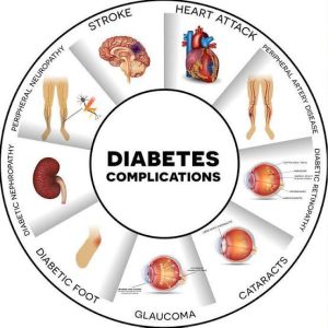 Foods to Avoid if You Are Pre-Diabetic