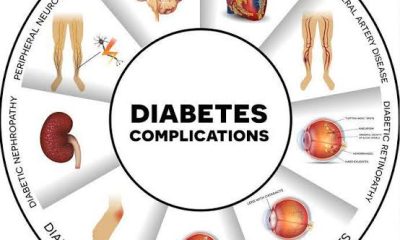 Foods to Avoid if You Are Pre-Diabetic