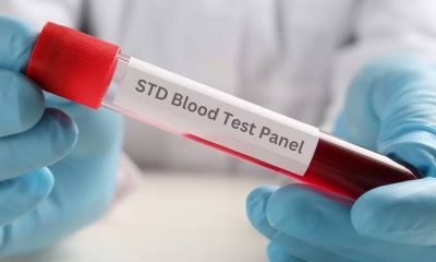 HIV Symptoms 7 Days After Exposure: What You Should Know