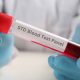 HIV Symptoms 7 Days After Exposure: What You Should Know