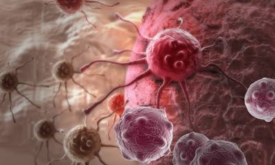 First Signs of Cancer that are Often Overlooked