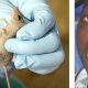 Early Signs of Lassa Fever Nigerians Should Never Ignore