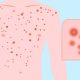 HIV Test Prices in Nigeria: Private and Public Hospital Comparison
