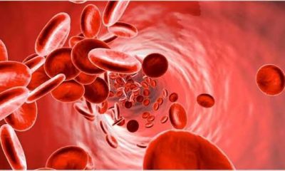 Signs of Anemia in Nigerian Children Parents Should Watch For
