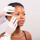 Top Dermatologists in Lagos, Ibadan, Ekiti and Abuja for Acne Treatment
