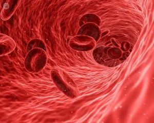 Foods Rich in Iron for Nigerians Living with Anemia