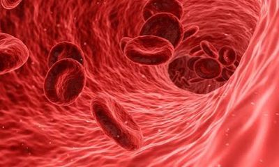 Foods Rich in Iron for Nigerians Living with Anemia