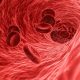 Foods Rich in Iron for Nigerians Living with Anemia