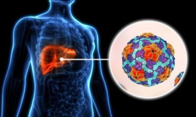 How to Know If You Have Hepatitis B: Symptoms and Tests in Nigeria