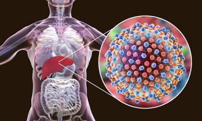 Latest Hepatitis B Treatment Options in Nigeria