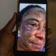 Side Effects of Skin Bleaching Creams Nigerians Should Know About